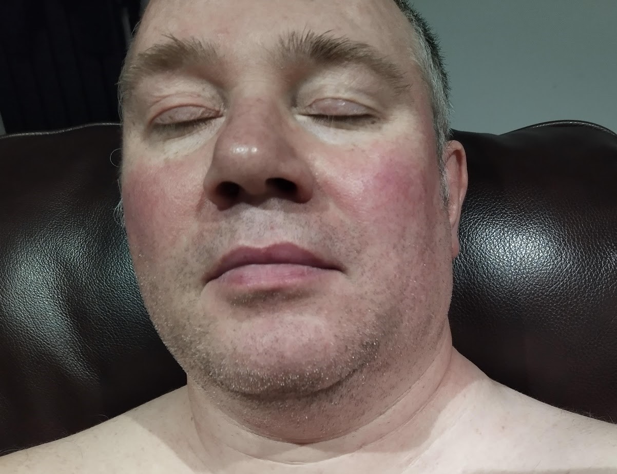 Cancer lump 15th November 2020